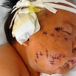 FILADELFIA EM NOTICIAS BEBÊ 90 TESOURADAS